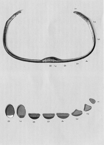 reflexbogen_sections.jpg